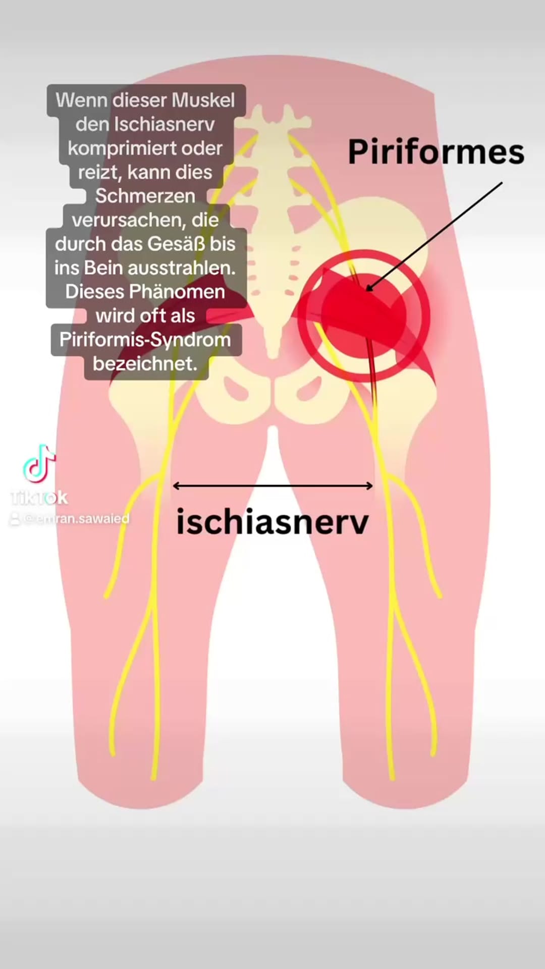@physiolocal on ReverseGram